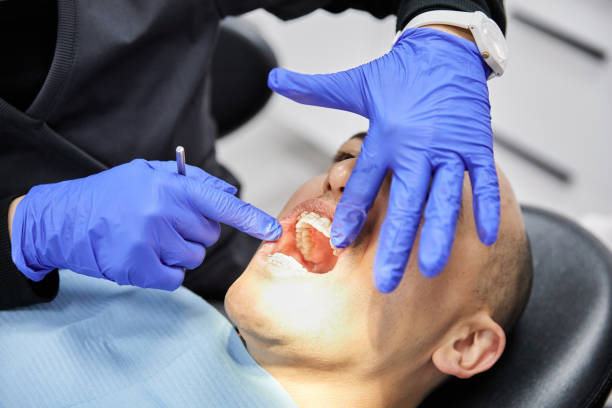 Best Emergency Dental Extractions in Willamina, OR