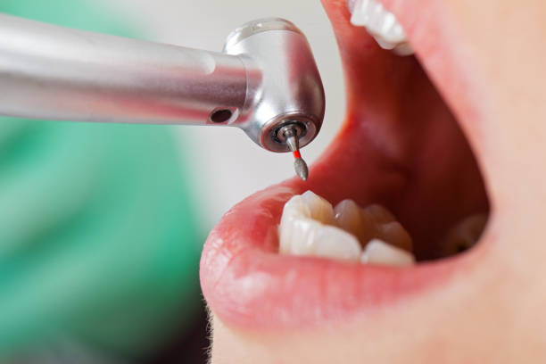 Best Emergency Dental Care for Abscessed Tooth in Willamina, OR